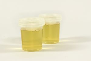 Read more about the article Urine Super Absorbent Solidifier Review