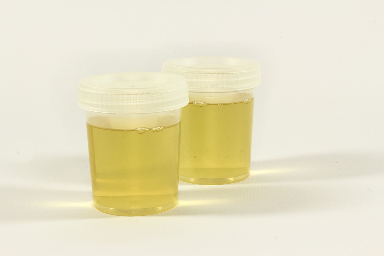 Urine Super Absorbent Solidifier Review